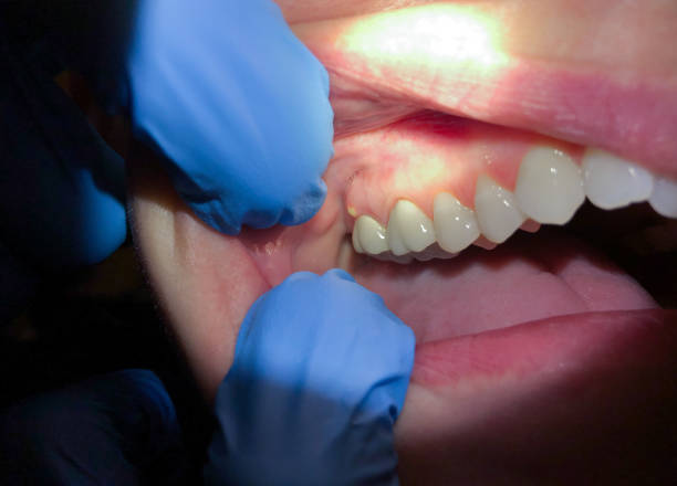 Best Walk-In Emergency Dentist in Bradley Gardens, NJ