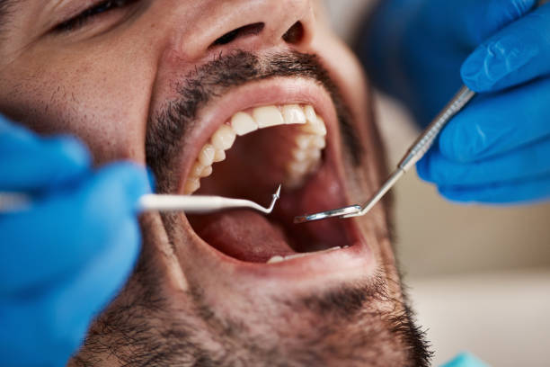 Best Same-Day Emergency Dentist in Bradley Gardens, NJ